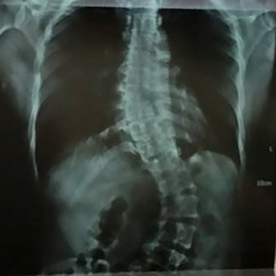 Orthopedic and Spine